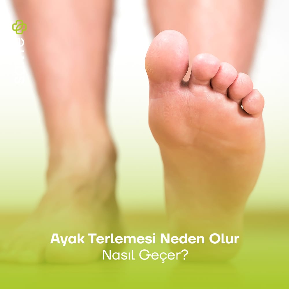 Ayak Terlemesi neden olur nasıl geçer