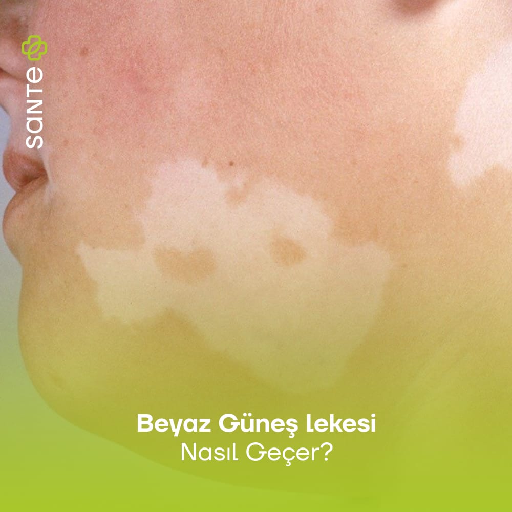 Beyaz Güneş lekesi