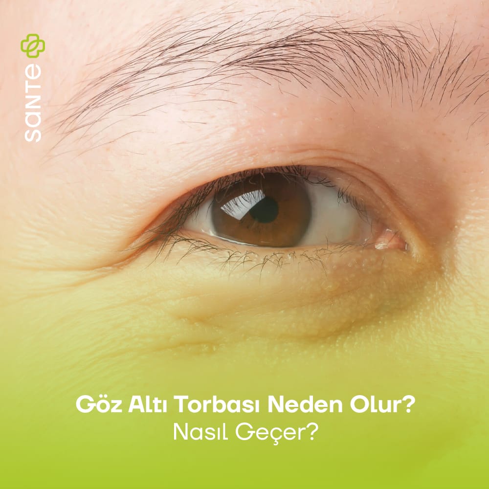 Göz Altı Torbası