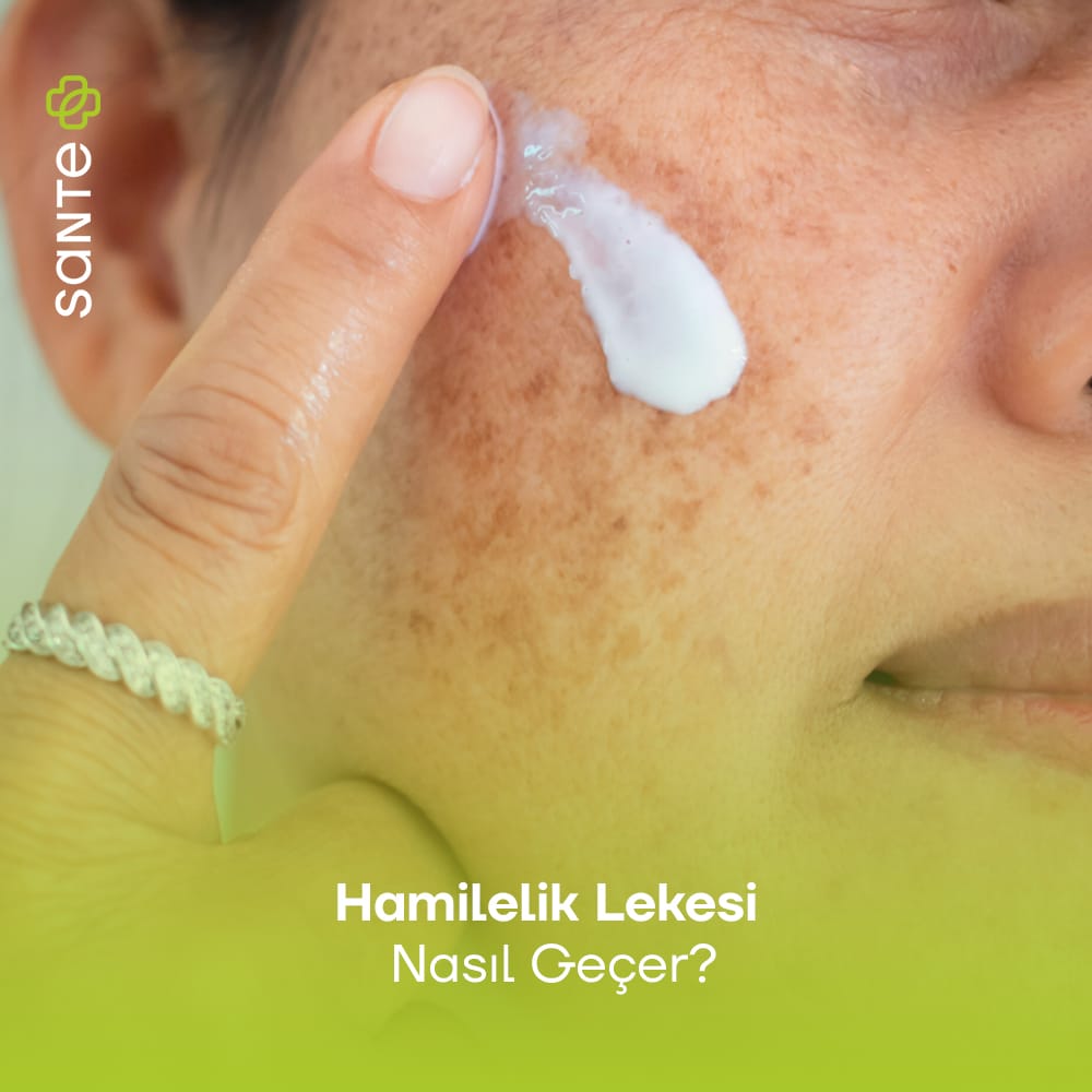 Hamilelik Lekesi