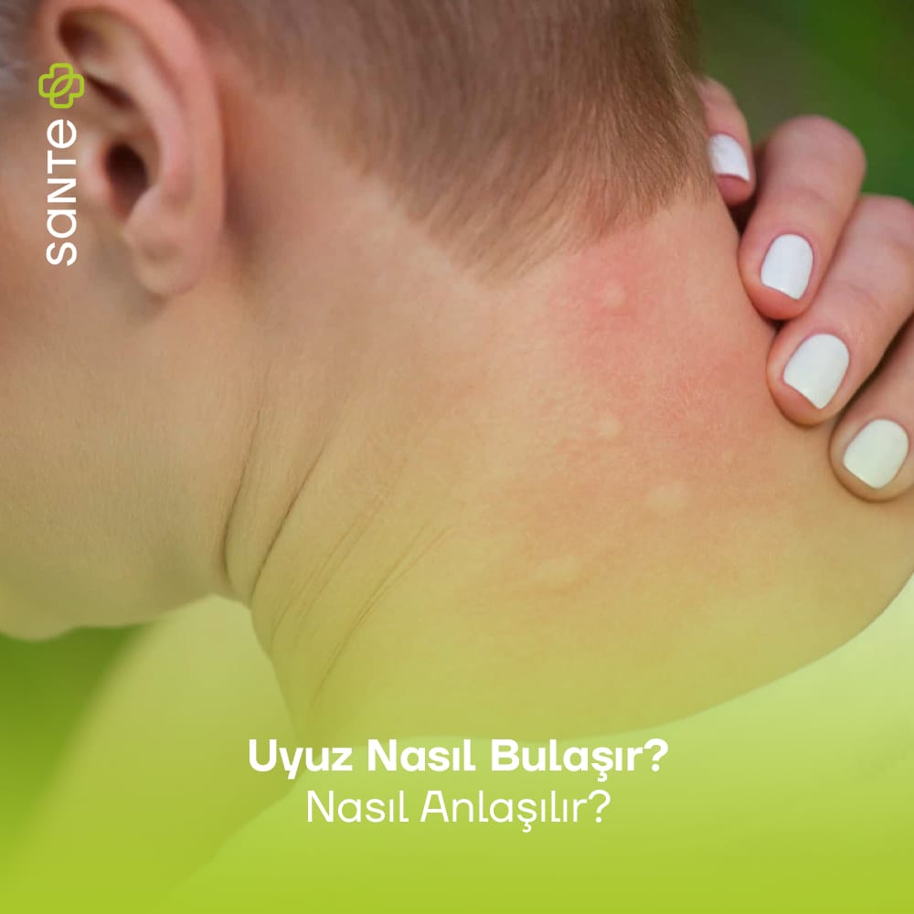 Uyuz Nasıl Bulaşır
