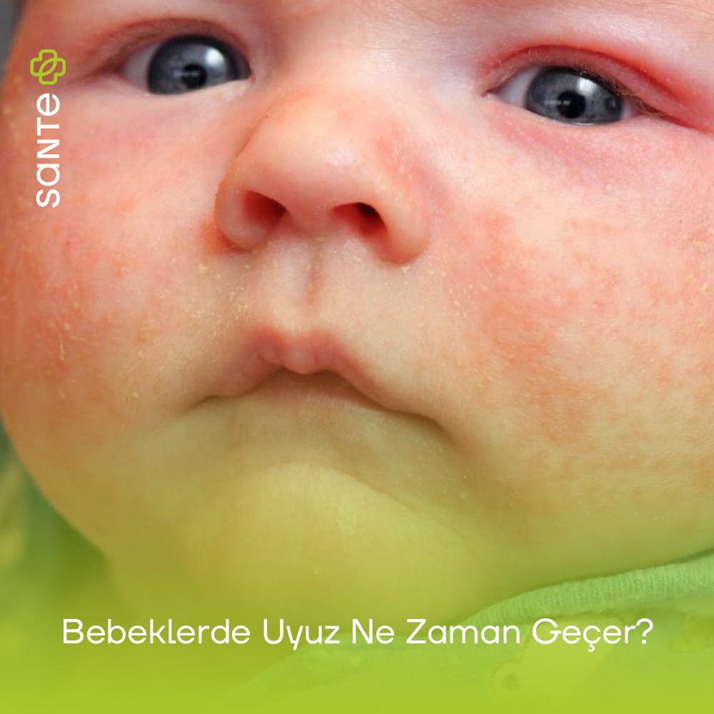 Bebeklerde Uyuz Ne Zaman Geçer