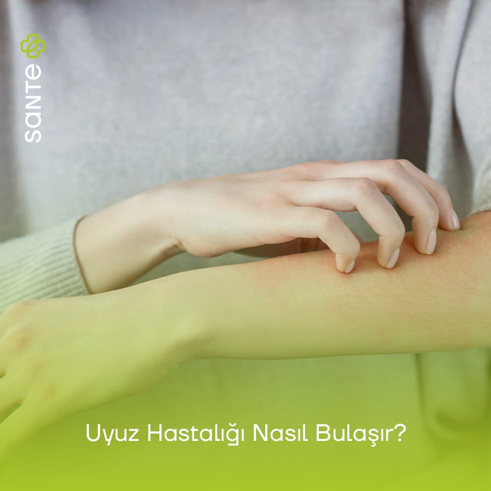 Uyuz Hastalığı Nasıl Bulaşır