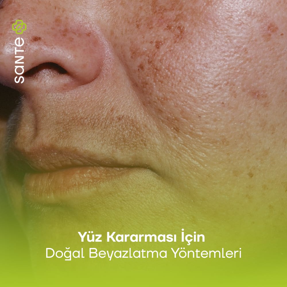 Yüz Kararması İçin Doğal Beyazlatma Yöntemleri