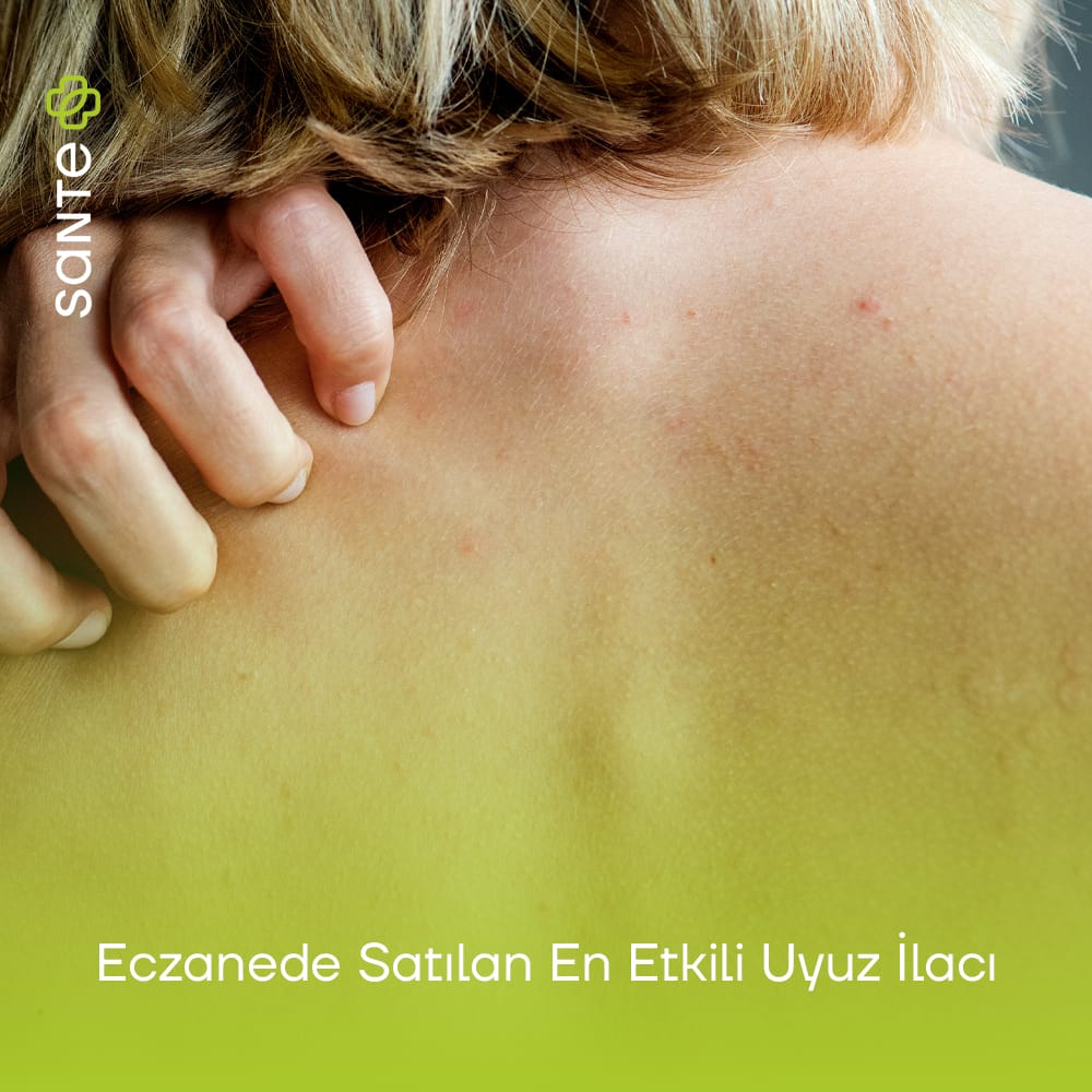 Eczanede Satılan En Etkili Uyuz ilacı