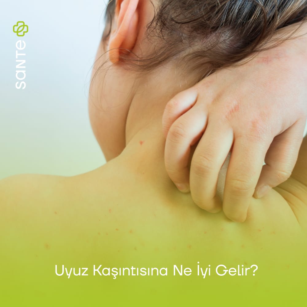 Uyuz Kaşıntısına Ne İyi Gelir