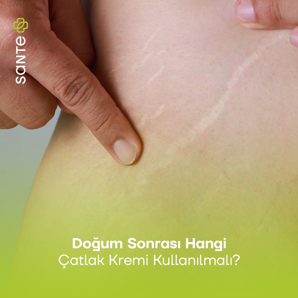 Doğum Sonrası Hangi Çatlak Kremi Kullanılmalı