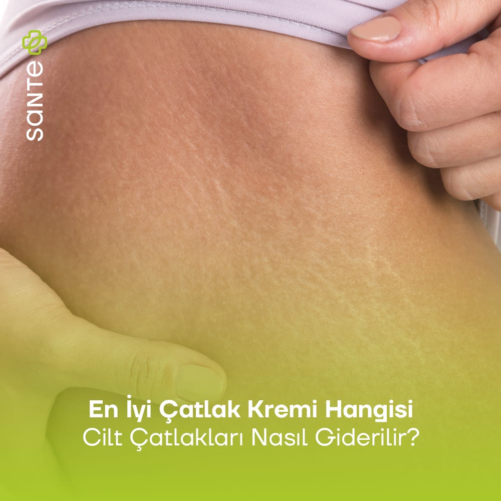 En iyi Çatlak Kremi Hangisi