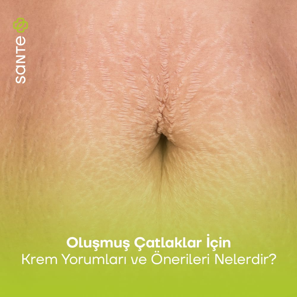 Oluşmuş Çatlaklar İçin Krem Yorumları ve Önerileri