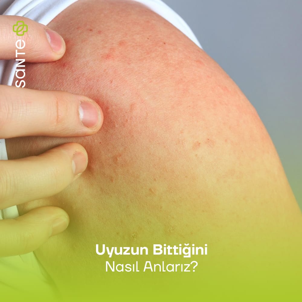 Uyuzun Bittiğini Nasıl Anlarız