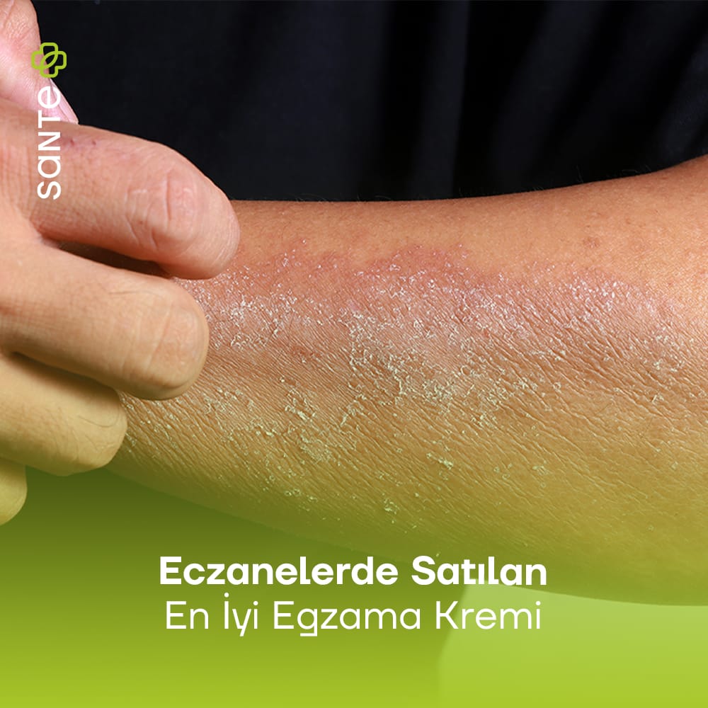 Sante Plus Eczanelerde Satılan En İyi Egzama Kremi